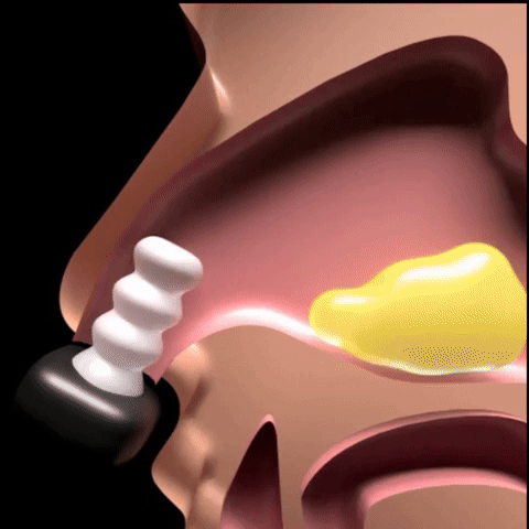 How targeted light therapy works.